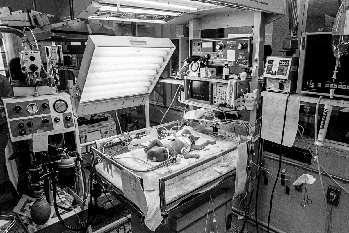 Preemie Baby unit at St Joseph&#039;s Hospital. I.C.U. The technology in a modern hospital. Showing IV Pump. Cardiac &amp; Respiratory monitor. Respirator. Umbilical catheter in navel. 3 Electrodes for heart &amp; respiratory rate, endotracheal tube in nose. Preemie baby under 2 lb at birth.