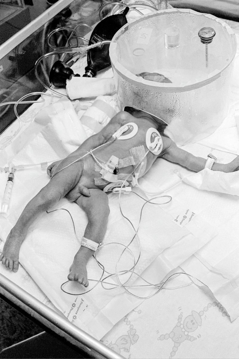 USA. ARIZONA. Phoenix. Preemie Baby unit at St Joseph&#039;s Hospital. Preemie baby in I.C.U. showing Electrode, Umbilical Catheter, Temperature probe and a hood of oxygen at 50% also humidified to reduce irritation. Notice the fancy sheets - every measure is used to lower the feeling of tension in the ward.