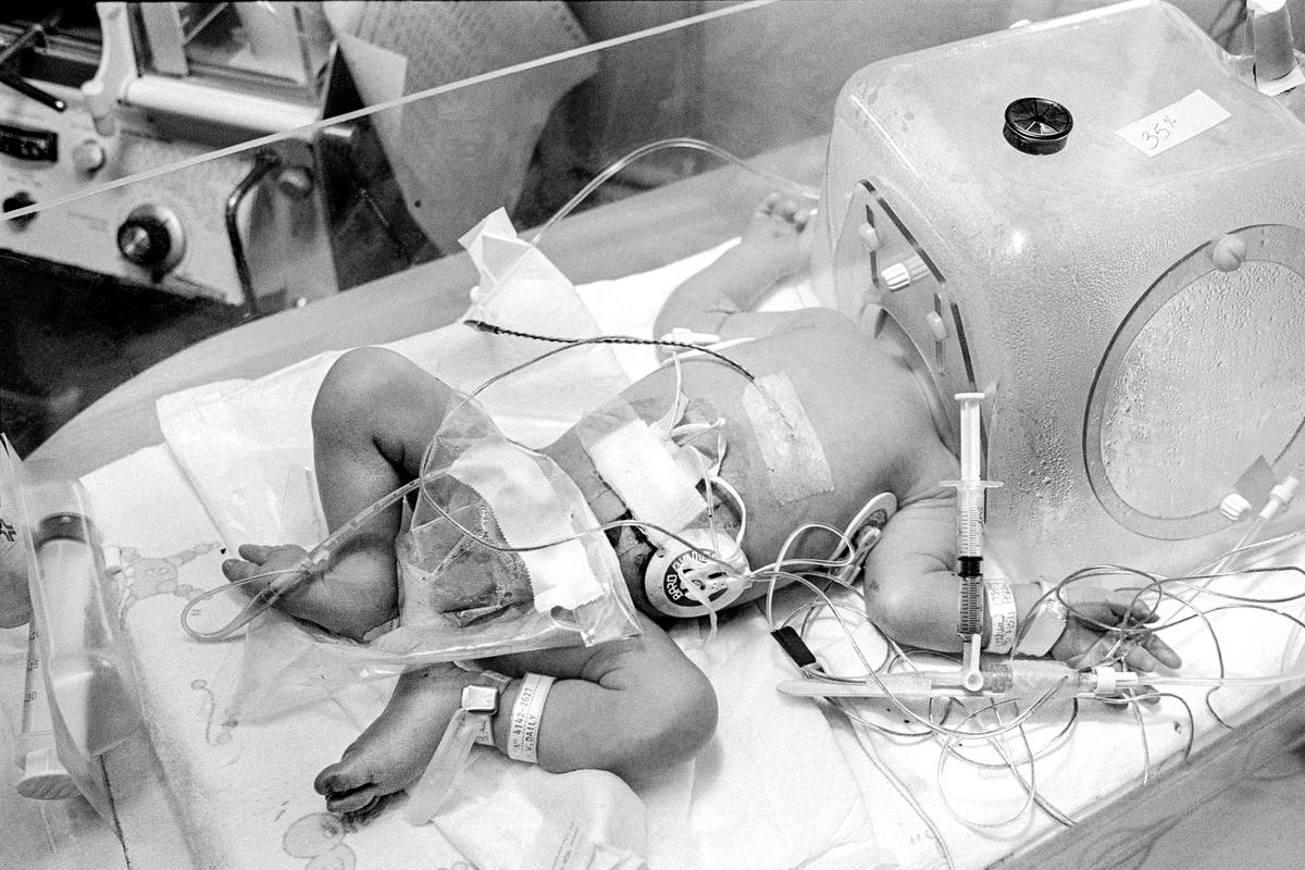 Preemie Baby unit at St Joseph&#039;s Hospital. I.C.U. Preemie baby with head in a humidifier and covered with the various attachments that help keep his functions stable. Phoenix, Arizona USA
