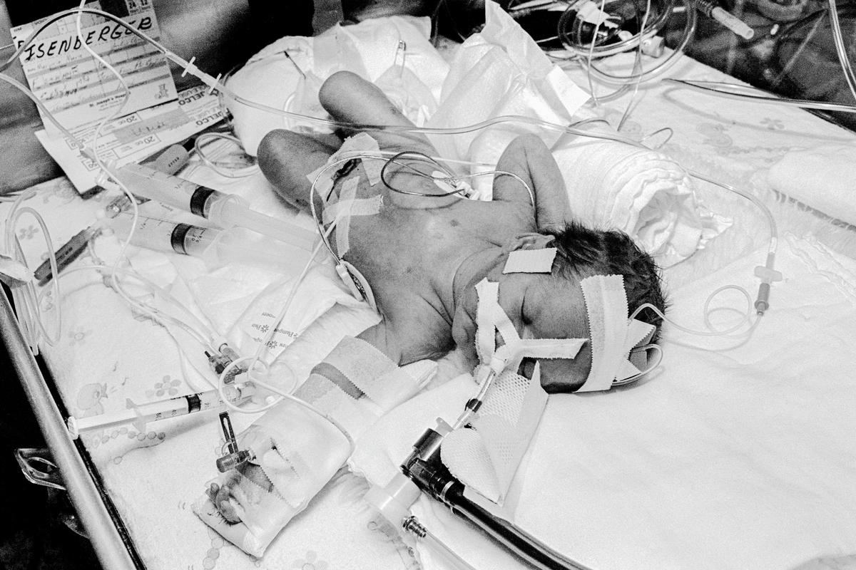 USA. ARIZONA. Phoenix. Preemie Baby unit at St Joseph&#039;s Hospital. I.C.U. Showing endo-tracteal tube, Umbilical catheter, electrode, and temperature probe.