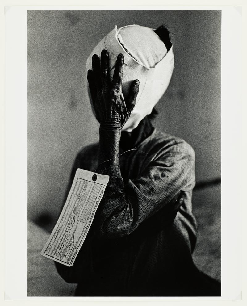 Civilian Victim, Vietnam, 1967