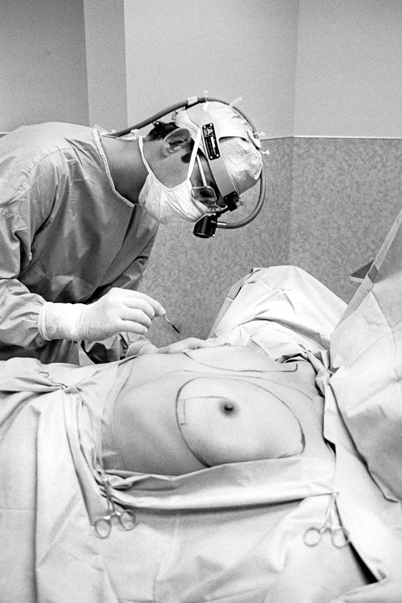 USA. ARIZONA. A breast silicon implant. Phoenix. 1980.